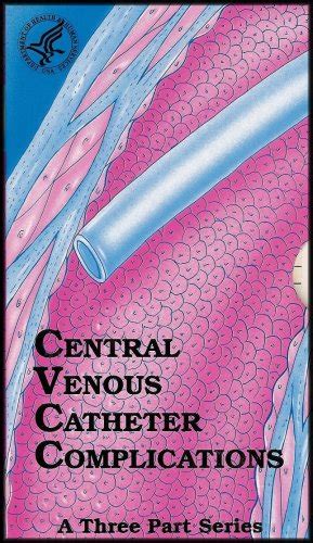 Buy Central Venous Catheter Complications Reduce The Incidence Of