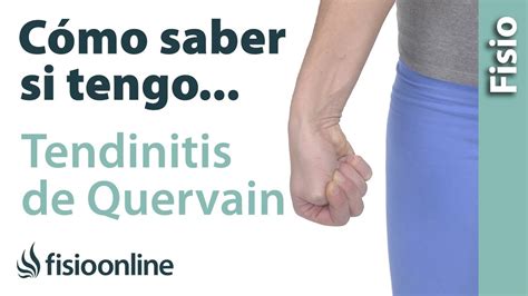 Atenci N C Mo Identificar Los S Ntomas De La Tendinitis De Quervain Y