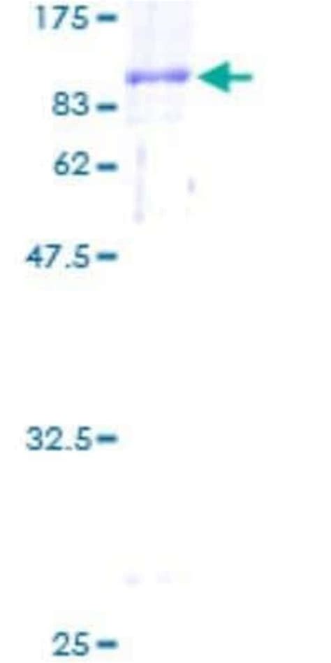 Novus Biologicals Recombinant Human CTP Synthase GST N Term Protein