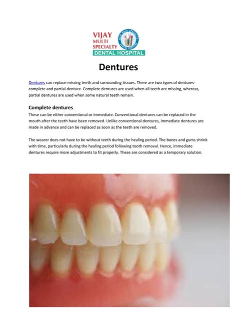 Dentures By Vijay Dental Hospital Issuu