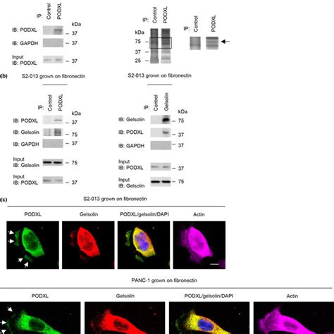 Roles Of Podocalyxin Like Protein PODXL In Translocation Of Gelsolin