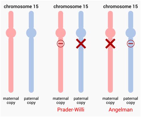 Prader Willi Syndrome Genetics