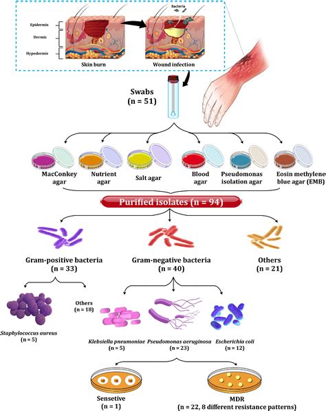 Pseudomonas Aeruginosa Burn Infection