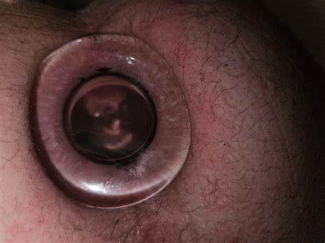 Asshole Destroying Nude Pics Xhamster