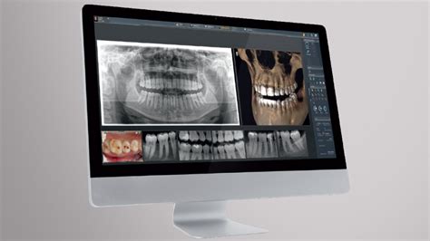 Digitale Röntgendiagnostik Dr med dent Timur Halfin