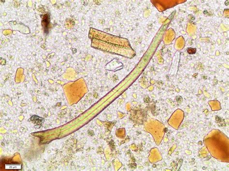 Parasitología Controllab