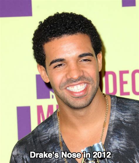 Drake Nose Job Rumors True Or False Latest Plastic Surgery Gossip