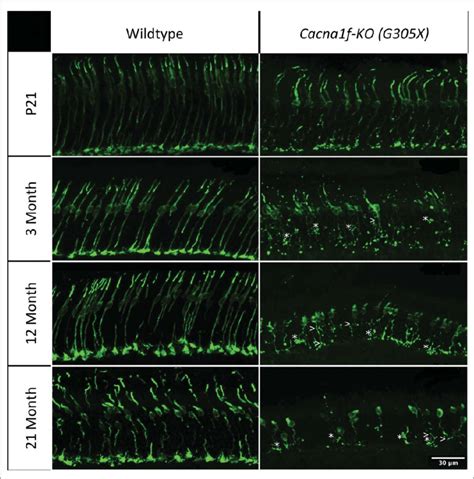 Cone Arrestin Mcar Immunolabeled Age Matched Wildtype And G305x