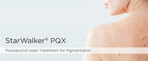 Pico Laser Treatment For Pigmented Lesions Healthsprings