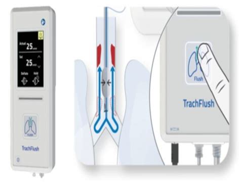 Asahi Kasei Medical And Aw Technologies Sign Agreement For Trachflush