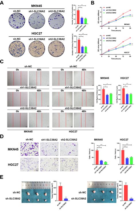 Tumor Promoting Effects Of SLC39A2 In GC Cells A Representative