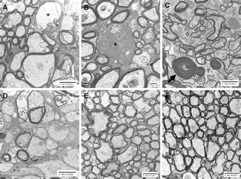 Figure 1 From Opa1 Deficiency Associated With Increased Autophagy In