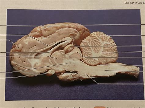 Medium Section Of Sheep Brain Diagram Quizlet