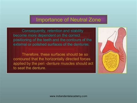 Concept Of Neutral Zone Dental Seminars