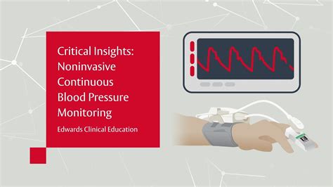 Critical Insights Noninvasive Continuous Blood Pressure Monitoring