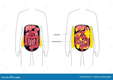 Visceral Fat Diagram Stock Vector Illustration Of Body 280197355