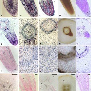 In Situ Localization Of Gmpk Gmpepc And Gmca Gene Transcripts