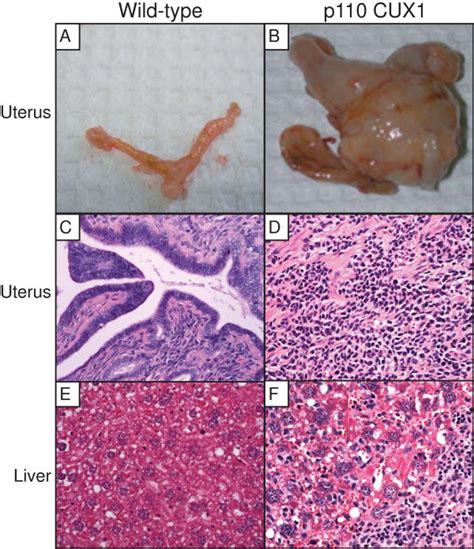 P Cux Transgenic Mice Develop Uterine Histiocytic Sarcomas With