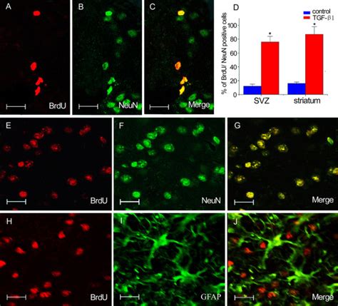 Double Immunofluorescence Staining For BrdU NeuN And GFAP The