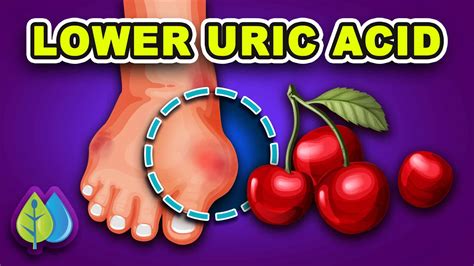 How To Quickly Remove Uric Acid Crystals From Your Body To Prevent Gout