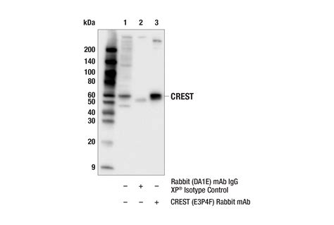 Crest E P F Rabbit Mab Cell Signaling Technology