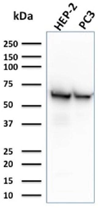 Anti Hsp60 Monoclonal Antibody Clone Cptc Hspd1 1