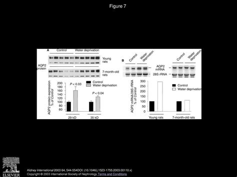 Resistance Of Mtal Na Dependent Transporters And Collecting Duct