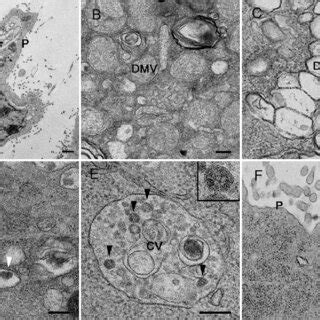 Tem Of Vero E Cells Infected With Sars Cov Ultrathin Sections Of