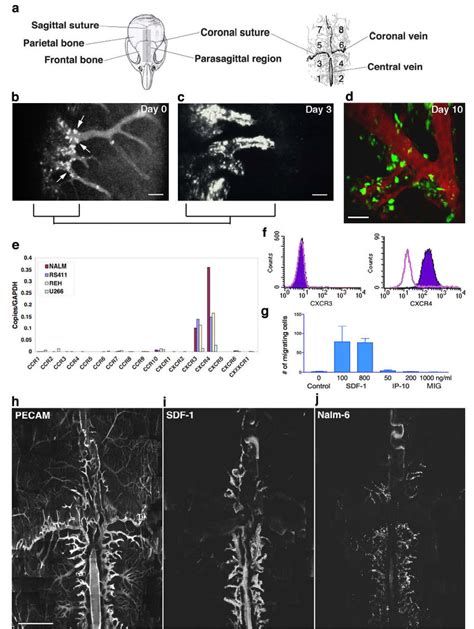 Leukemic Cell Homing Engraftment In Mouse Skull Bm In Vivo A Cartoons