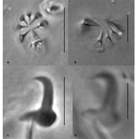 Differences Between Sclerotized Structures Of The Gyrodactylus