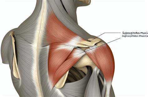 Tendinitis Del Supraespinoso Síntomas Tratamiento Y Recuperación