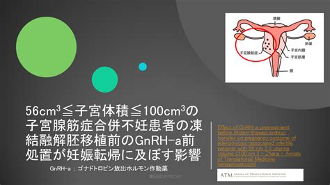 「子宮腺筋症と胚移植」 津田沼ivfクリニック Tsudanuma Ivf Clinicのブログ