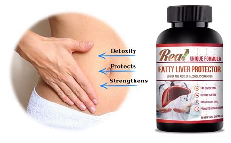 Best Fatty Liver Support Supplement Herbal Liver Support Curcumin