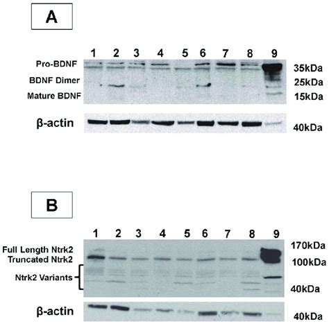 Bdnf And Ntrk2 Expression In The Human Uterus Uterine Homogenates Were