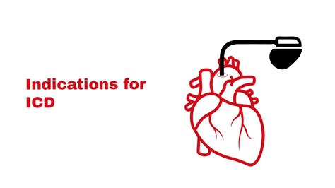 Indications for ICD ~ Stat Cardiologist