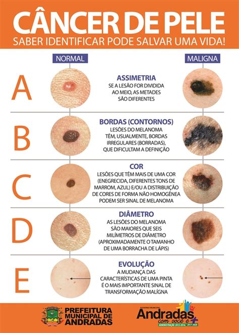 Cartaz Cancer De Pele Cosmetologia