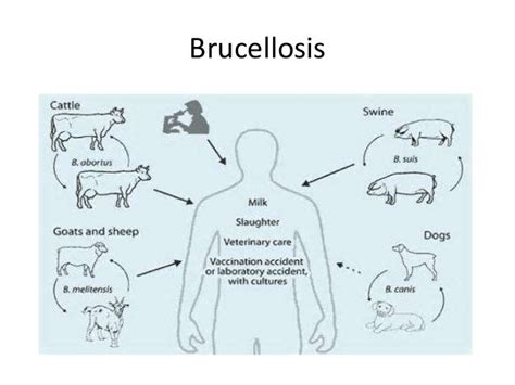 Brucellosis