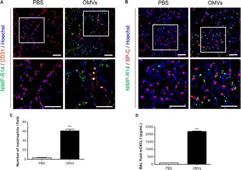 Frontiers Outer Membrane Vesicles Derived From Escherichia Coli Regulate Neutrophil Migration