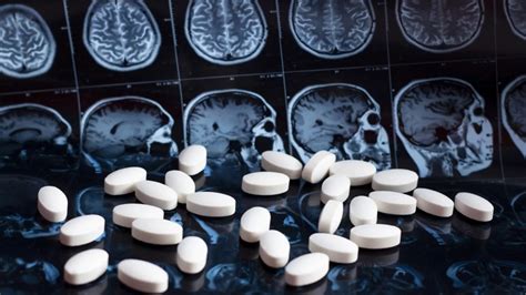 Estados Unidos Aprueba Medicamento Que Retrasa Avance Del Alzheimer