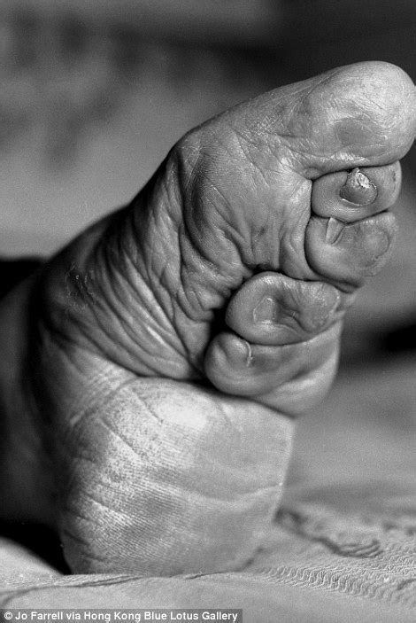 Chinese Grandmothers Uncover Their Deformed Lotus Feet Daily Mail