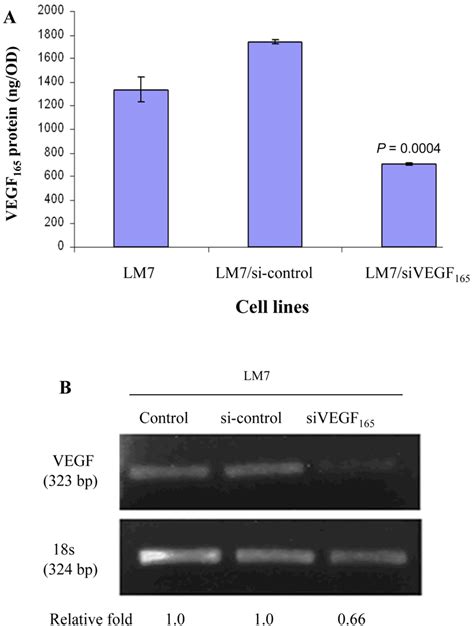 Transfection With Sivegf 165 Decreased Expression Of Vegf 165 Rna And