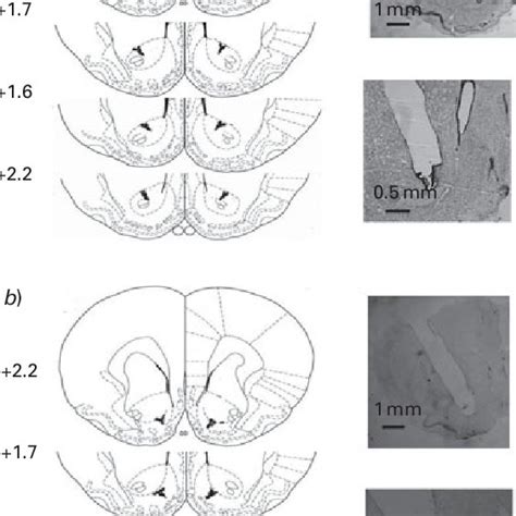 Representative Cannula Placements In The Nucleus Accumbens Core A And