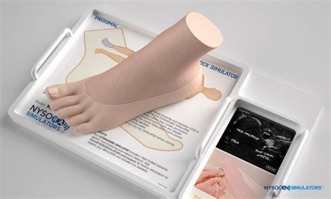 Ultrasoundguided Ankle Block Nysora Web App Nysora