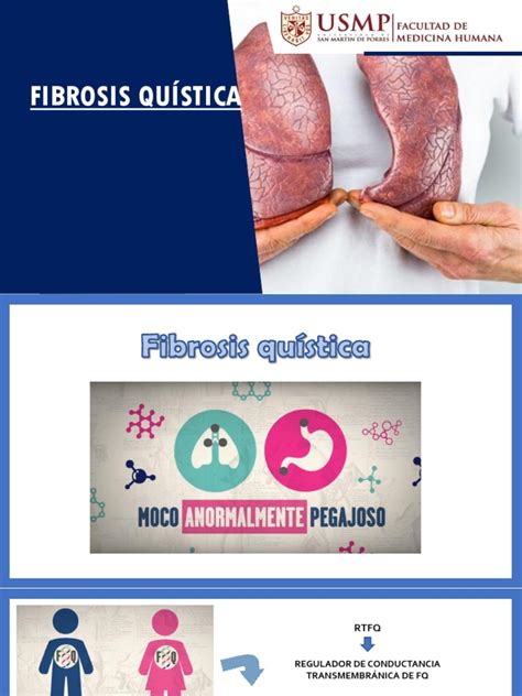 Fibrosis Quística Pdf Biología Molecular Medicina Clinica