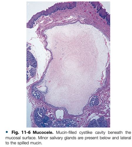 Christensen Salivary Gland Histo Pics Flashcards Quizlet