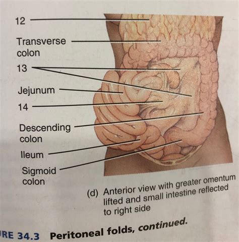 34 3d Peritoneal Anterior View With Greater Omentum Lifted And Small