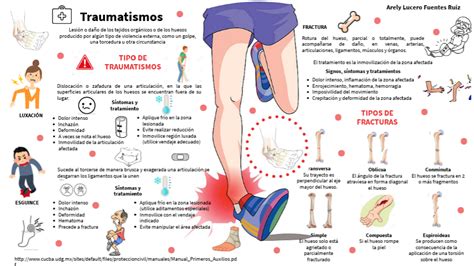 Signos De Fractura De Hueso