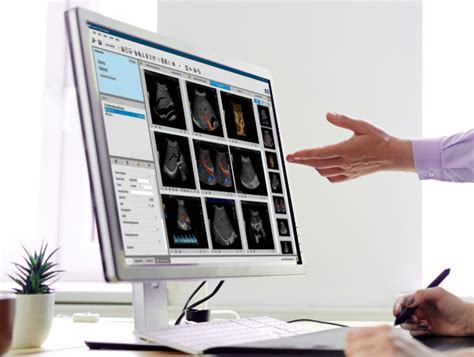 Ultraschall Service And Support Ge Healthcare