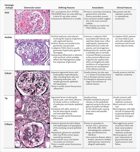 Focal Segmental Glomerulosclerosis Nejm