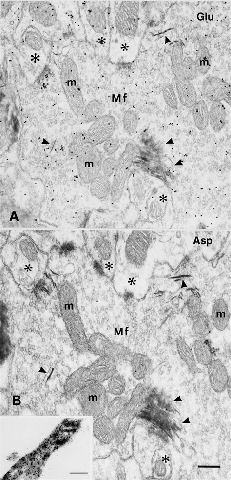 11 Combination Of Anterograde Labeling And Postembedding Immunogold